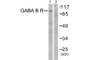 Western Blotting (WB) image for anti-GABA B Receptor (C-Term) antibody (ABIN1848554) (GABA B Receptor (C-Term) antibody)