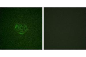 Immunofluorescence analysis of A549 cells, using ACK1 (Phospho-Tyr284) antibody. (TNK2 antibody  (pTyr284))