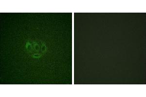 Immunofluorescence analysis of A549 cells, using ACK1 (Phospho-Tyr284) antibody. (TNK2 antibody  (pTyr284))
