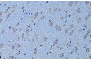 Immunohistochemistry of paraffin-embedded Mouse brain using HADH Polyclonal Antibody at dilution of 1:100 (40x lens). (HADH antibody)