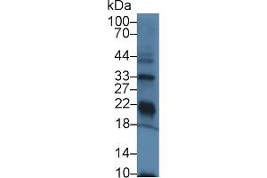 Detection of GPX3 in Rat Kidney lysate using Polyclonal Antibody to Glutathione Peroxidase 3, Plasma (GPX3) (GPX3 antibody  (AA 3-72))