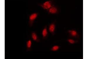 ABIN6267396 staining K562 by IF/ICC. (GATA1 antibody  (pSer310))