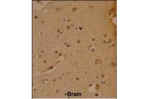 Formalin-fixed and paraffin-embedded human brain reacted with SOX4 Antibody (N-term), which was peroxidase-conjugated to the secondary antibody, followed by DAB staining. (SOX4 antibody  (N-Term))