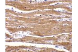 Immunohistochemistry of BACE2 in mouse heart with BACE2 antibody at 10 μg/ml. (BACE2 antibody  (N-Term))