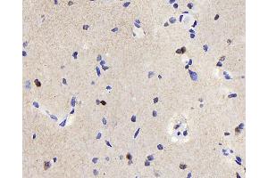 Immunohistochemistry analysis of paraffin-embedded rat brain using TSC22D3 Polyclonal Antibody at dilution of 1:300. (TSC22D3 antibody)