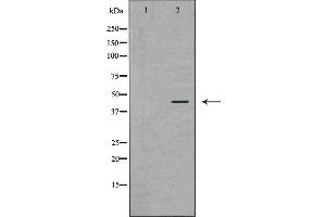 Western blot analysis of MCF-7  lysate using ATXN3 antibody. (Ataxin 3 antibody  (Internal Region))