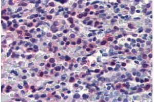 Human Spleen (formalin-fixed, paraffin-embedded) stained with CASP7 antibody ABIN462357 followed by biotinylated anti-mouse IgG secondary antibody ABIN481714, alkaline phosphatase-streptavidin and chromogen. (Caspase 7 antibody)