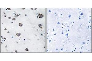 Immunohistochemistry analysis of paraffin-embedded human brain, using AIFM3 Antibody. (AIFM3 antibody  (AA 10-59))