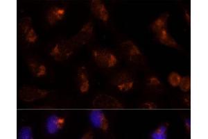 Immunofluorescence analysis of U-2 OS cells using SEC14L2 Polyclonal Antibody at dilution of 1:100 (40x lens).