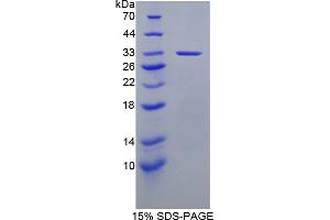 Image no. 1 for Transient Receptor Potential Cation Channel, Subfamily V, Member 2 (TRPV2) (AA 1-264) protein (His tag) (ABIN6237129)
