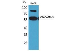 Western Blotting (WB) image for anti-Carcinoembryonic Antigen-Related Cell Adhesion Molecule 1/5 (CEACAM1/5) (N-Term) antibody (ABIN3180999) (CEACAM1/5 antibody  (N-Term))