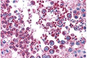 Human Testis: Formalin-Fixed, Paraffin-Embedded (FFPE) (MAGEA3 antibody  (AA 216-265))