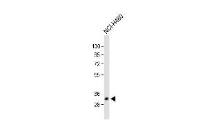 All lanes : Anti-VDAC3 Antibody (Center) at 1:1000 dilution Lane 1: Human heart lysate Lane 2: NCI- whole cell lysate Lane 3: A431 whole cell lysate Lane 4: U-2OS whole cell lysate Lane 5: Mouse testis lysate Lane 6: Rat brain lysate Lysates/proteins at 20 μg per lane. (VDAC3 antibody  (AA 156-183))