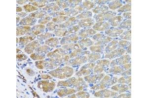 Immunohistochemistry of paraffin-embedded Mouse stomach using VPS37A Polyclonal Antibody at dilution of 1:100 (40x lens). (VPS37A antibody)