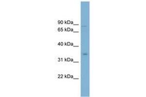 Image no. 1 for anti-Glycerol Phosphate Dehydrogenase 2, Mitochondrial (GPD2) (C-Term) antibody (ABIN6742064) (GPD2 antibody  (C-Term))