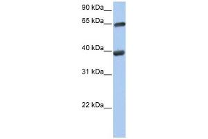 TKT antibody used at 1 ug/ml to detect target protein. (TKT antibody)