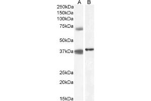 ABIN571104 (1µg/ml) staining of Peripheral Blood Mononucleocyte (A) and (0.