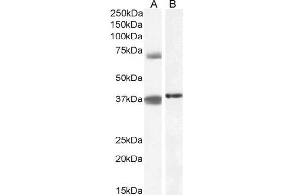 TRIM29 antibody  (Internal Region)