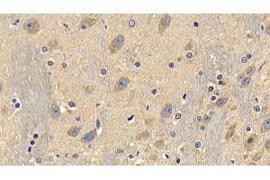 Immunohistochemistry (IHC) image for anti-Receptor (TNFRSF)-Interacting serine-threonine Kinase 1 (RIPK1) (AA 1-179) antibody (ABIN7441205)
