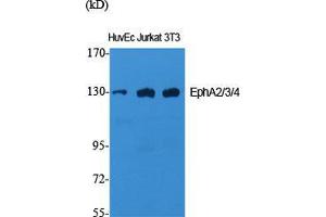 Western Blot (WB) analysis of specific cells using EphA2/3/4 Polyclonal Antibody.