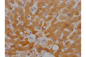 IHC image of ABIN7127790 diluted at 1:100 and staining in paraffin-embedded human liver tissue performed on a Leica BondTM system. (Recombinant RBP4 antibody)