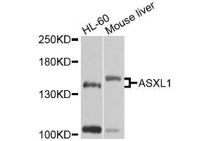 Western blot analysis of extracts of various cell lines, using ASXL1 antibody (ABIN6003622) at 1/1000 dilution. (ASXL1 antibody)
