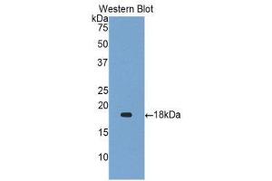 Western Blotting (WB) image for anti-Gastrokine 1 (GKN1) (AA 53-192) antibody (ABIN1859011) (Gastrokine 1 antibody  (AA 53-192))