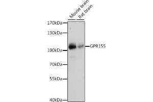 Western blot analysis of extracts of various cell lines, using GPR155 antibody (ABIN7267298) at 1:1000 dilution. (GPR155 antibody  (AA 721-870))