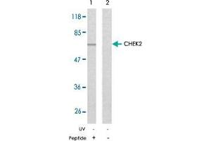 Western blot analysis of the extracts from Jurkat cells using CHEK2 polyclonal antibody  .