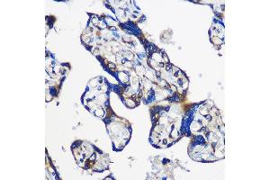 Immunohistochemistry of paraffin-embedded Human placenta using EY Rabbit pAb (ABIN6135167, ABIN6140386, ABIN6225031 and ABIN6225033) at dilution of 1:100 (40x lens). (EYA1 antibody  (AA 100-250))