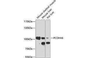 Western blot analysis of extracts of various cell lines, using PCDH antibody (ABIN6128584, ABIN6145301, ABIN6145302 and ABIN6220787) at 1:1000 dilution. (PCDHA6 antibody  (AA 1-230))