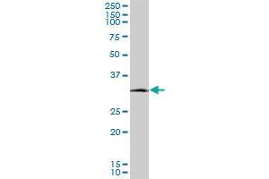 SIX3 monoclonal antibody (M08), clone 2B9. (SIX3 antibody  (AA 273-332))
