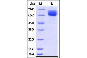 Human CD117, His Tag on SDS-PAGE under reducing (R) condition. (KIT Protein (AA 26-516) (His tag))