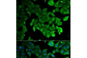 Immunofluorescence analysis of HeLa cells using LC3A/LC3B Polyclonal Antibody