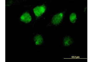 Immunofluorescence of purified MaxPab antibody to ZBTB26 on HeLa cell. (ZBTB26 antibody  (AA 1-441))