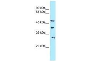 Image no. 1 for anti-U6 SnRNA Biogenesis 1 (USB1) (AA 150-199) antibody (ABIN6747953) (C16orf57 antibody  (AA 150-199))
