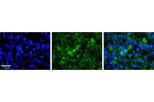 Immunohistochemistry (IHC) image for anti-WW Domain Binding Protein 11 (WBP11) (N-Term) antibody (ABIN2782558)