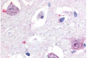 Anti-ROR Beta antibody  ABIN1049296 IHC staining of human brain, thalamus. (RORB antibody  (Hinge Region))