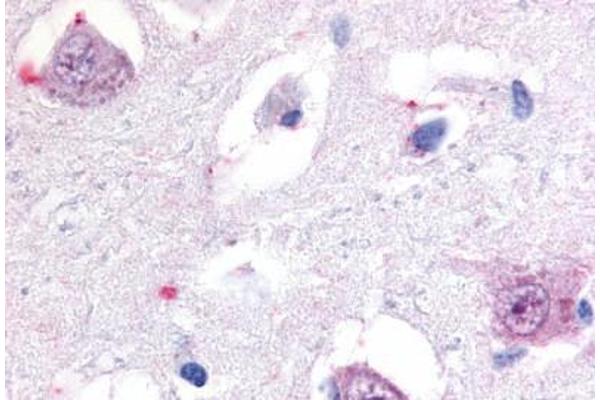 RORB antibody  (Hinge Region)