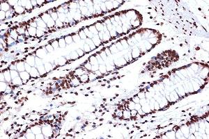 Immunohistochemistry of paraffin-embedded human colon using FUBP1 Rabbit mAb (ABIN7267128) at dilution of 1:100 (40x lens). (FUBP1 antibody)