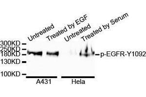 Western Blotting (WB) image for anti-Epidermal Growth Factor Receptor (EGFR) (pTyr1068) antibody (ABIN3020070) (EGFR antibody  (pTyr1068))