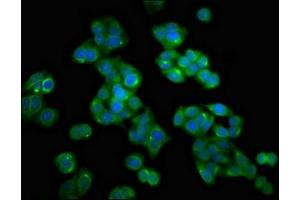 Immunofluorescent analysis of HepG2 cells using ABIN7155948 at dilution of 1:100 and Alexa Fluor 488-congugated AffiniPure Goat Anti-Rabbit IgG(H+L) (HMMR antibody  (AA 478-653))