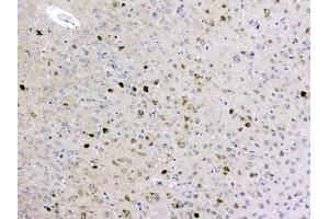 IHC analysis of GOLPH3 using anti-GOLPH3 antibody (ABIN6719570). (GOLPH3 antibody  (AA 56-298))