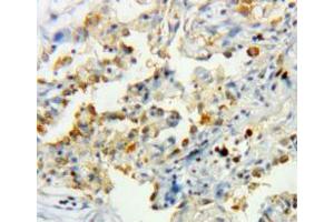 Used in DAB staining on fromalin fixed paraffin-embedded lung tissue (Catalase antibody  (AA 10-507))