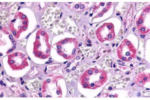Anti-TAAR6 antibody  ABIN1049384 IHC staining of human kidney, renal tubules. (TAAR6 antibody  (Cytoplasmic Domain))