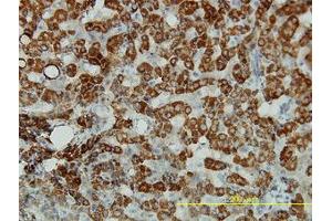 Image no. 1 for anti-Aldehyde Dehydrogenase 4 Family, Member A1 (ALDH4A1) (AA 1-564) antibody (ABIN599053) (ALDH4A1 antibody  (AA 1-564))