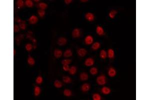 ABIN6266725 staining COS7 by IF/ICC. (TADA2L antibody)