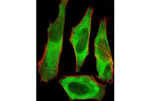 Fluorescent image of Hela cells stained with XAF1 Antibody (C-term) (ABIN6242701 and ABIN6577426). (XAF1 antibody  (C-Term))