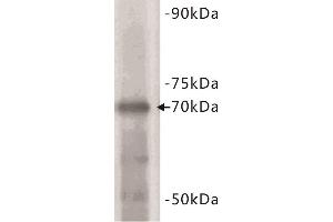 Western Blotting (WB) image for anti-Estrogen Receptor 1 (ESR1) (C-Term) antibody (ABIN1854892) (Estrogen Receptor alpha antibody  (C-Term))