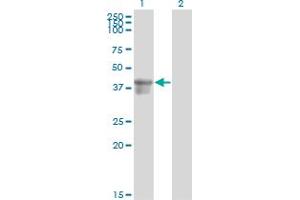 Western Blot analysis of SERPINB3 expression in transfected 293T cell line by SERPINB3 monoclonal antibody (M01), clone 2F5.